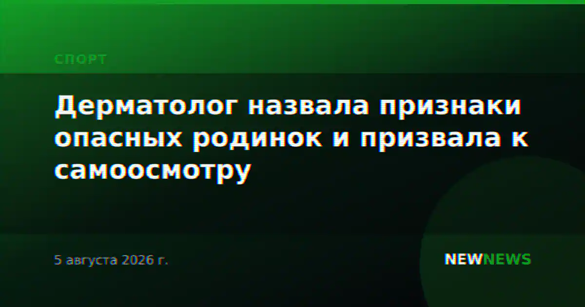 Дерматолог назвала признаки опасных родинок и призвала к самоосмотру