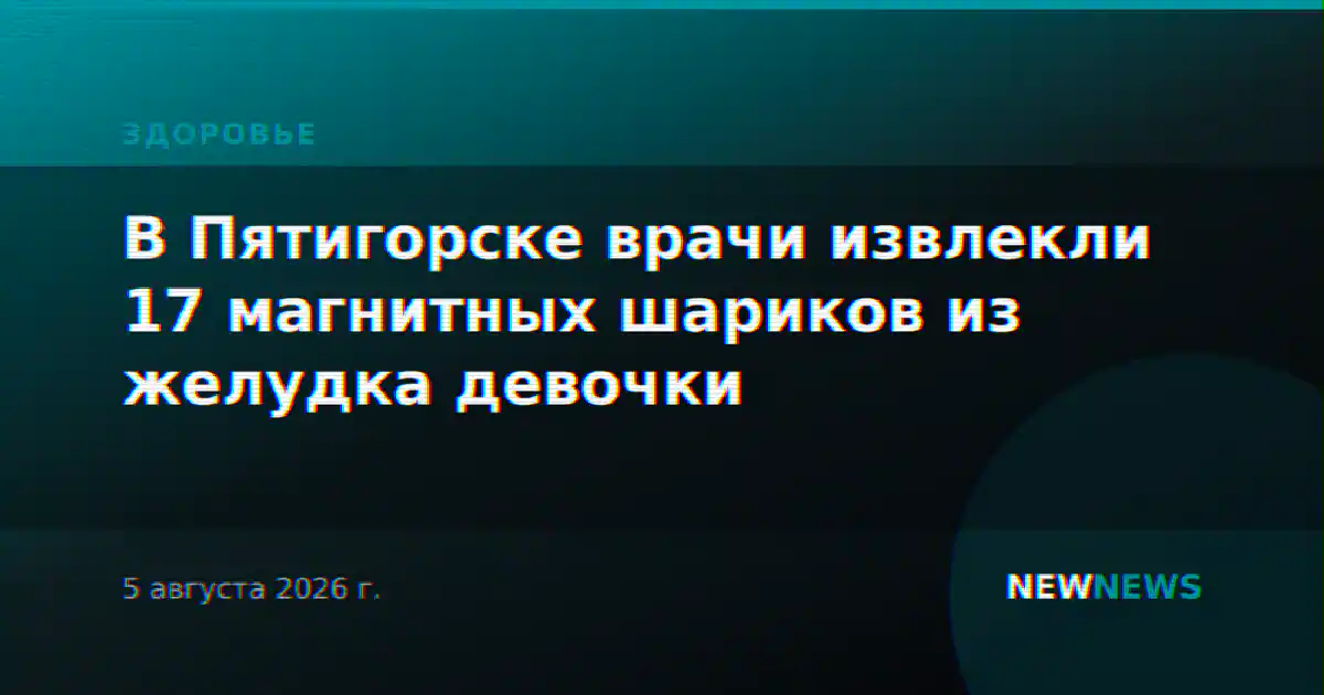 В Пятигорске врачи извлекли 17 магнитных шариков из желудка девочки