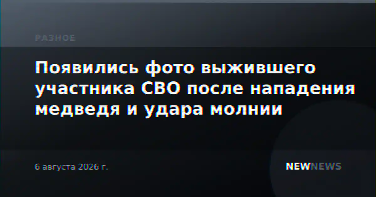 Появились фото выжившего участника СВО после нападения медведя и удара молнии
