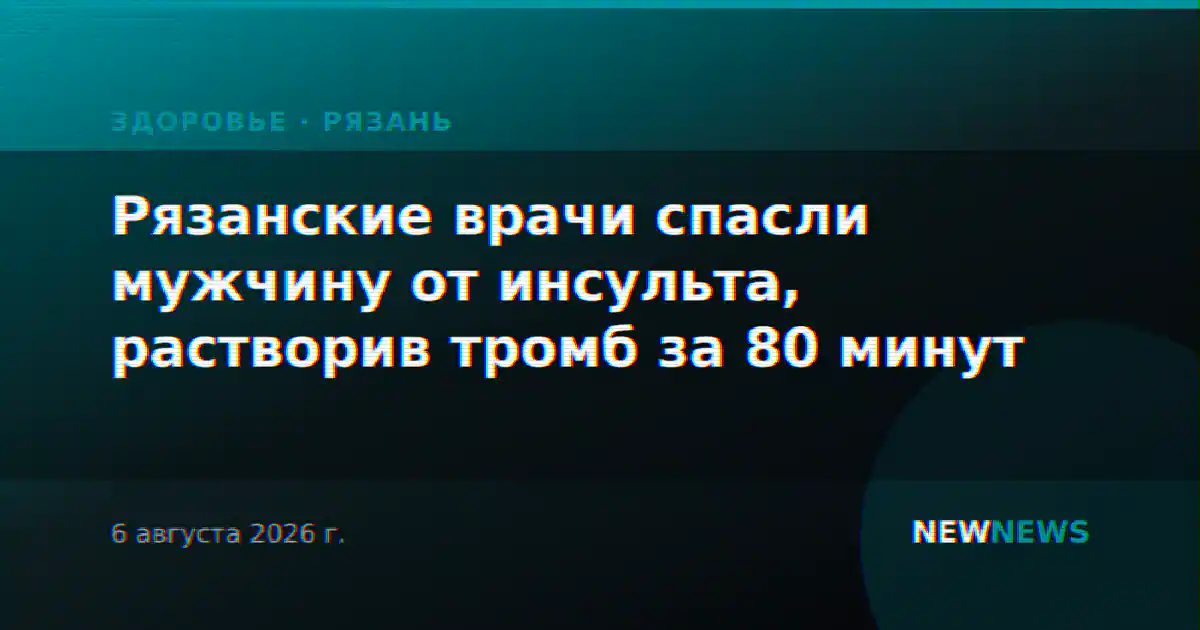 Рязанские врачи спасли мужчину от инсульта, растворив тромб за 80 минут