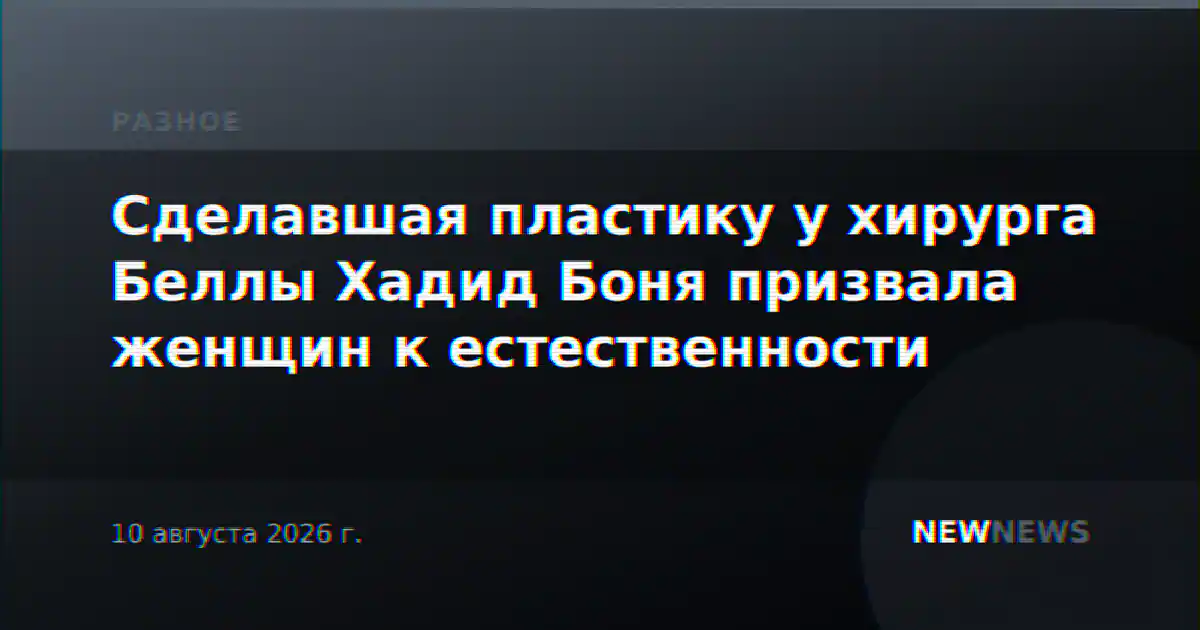Сделавшая пластику у хирурга Беллы Хадид Боня призвала женщин к естественности