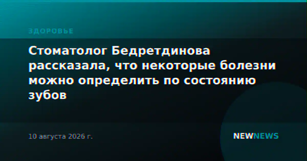 Стоматолог Бедретдинова рассказала, что некоторые болезни можно определить по состоянию зубов