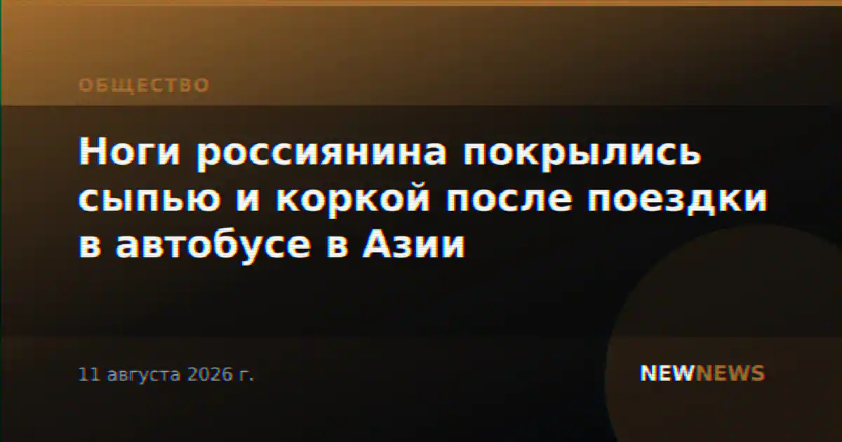 Ноги россиянина покрылись сыпью и коркой после поездки в автобусе в Азии