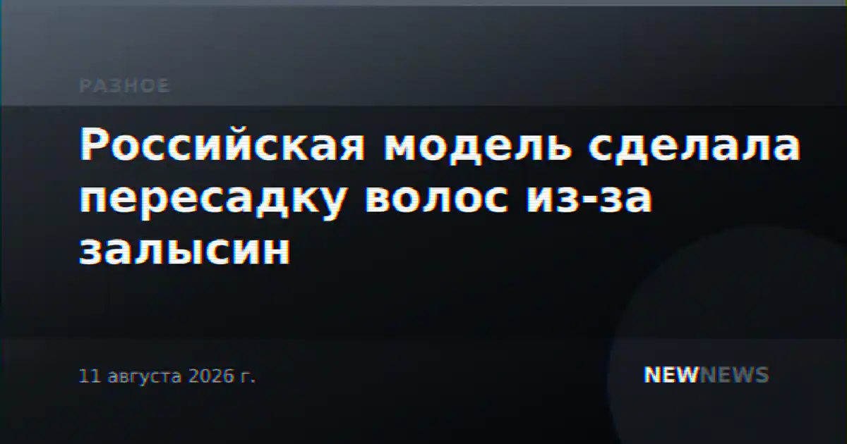 Российская модель сделала пересадку волос из-за залысин