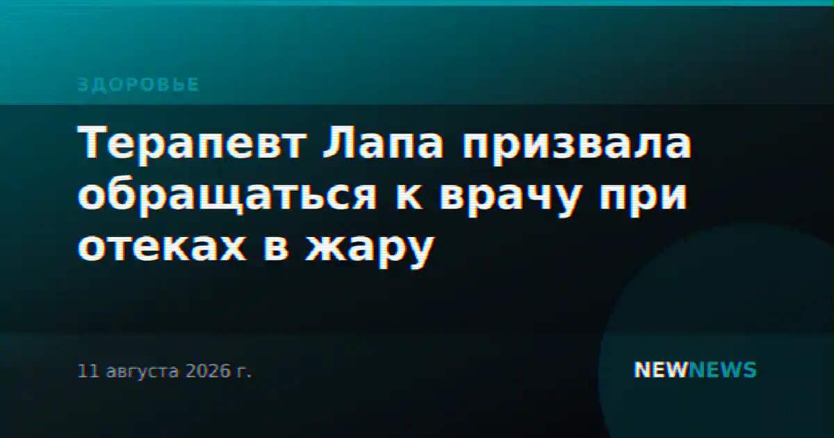 Терапевт Лапа призвала обращаться к врачу при отеках в жару