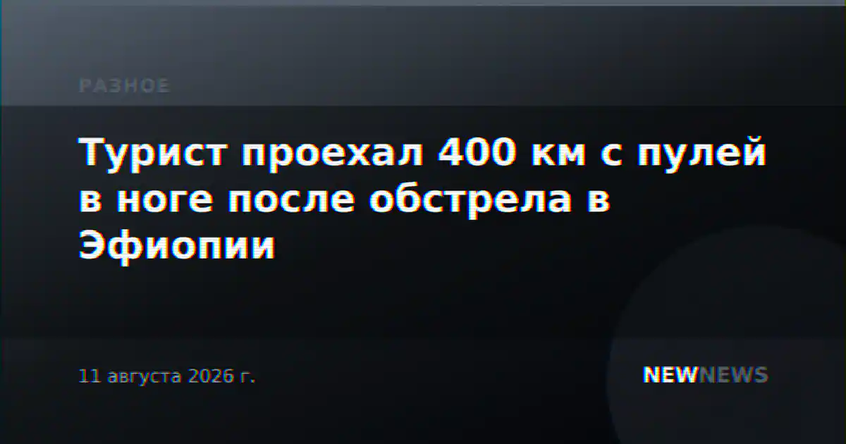Турист проехал 400 км с пулей в ноге после обстрела в Эфиопии