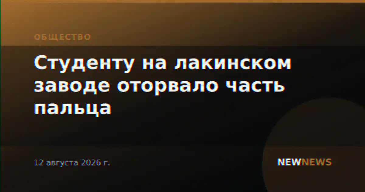 Студенту на лакинском заводе оторвало часть пальца