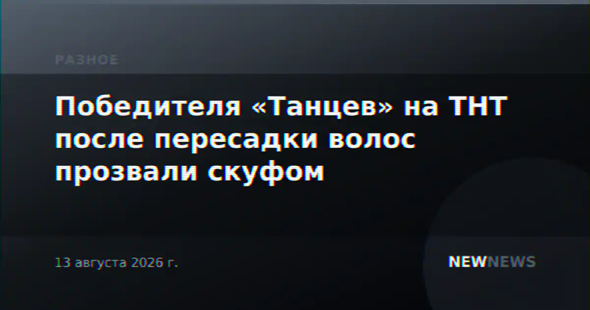 Победителя «Танцев» на ТНТ после пересадки волос прозвали скуфом