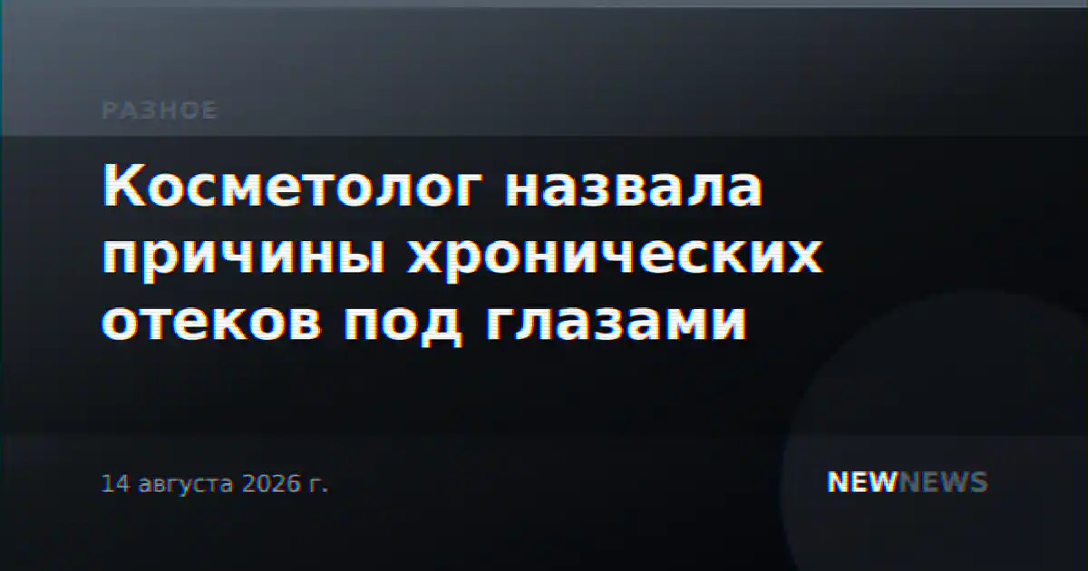 Косметолог назвала причины хронических отеков под глазами