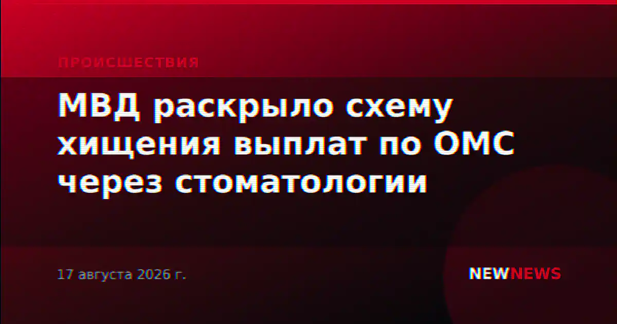 МВД раскрыло схему хищения выплат по ОМС через стоматологии