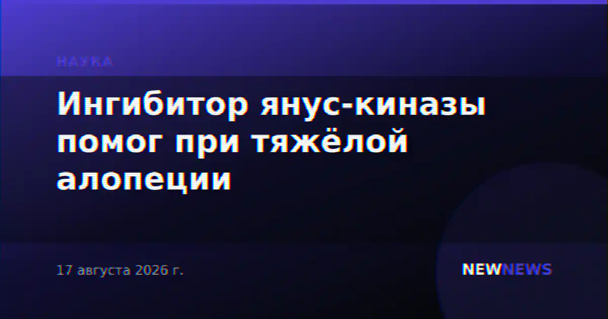 Ингибитор янус-киназы помог при тяжёлой алопеции