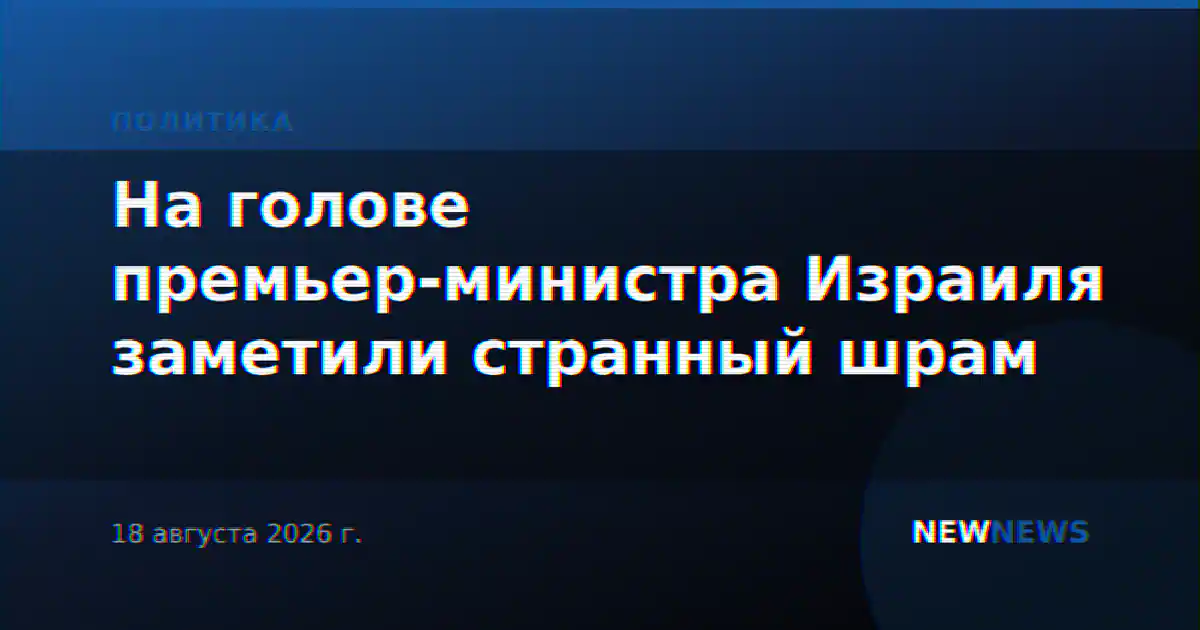 На голове премьер-министра Израиля заметили странный шрам