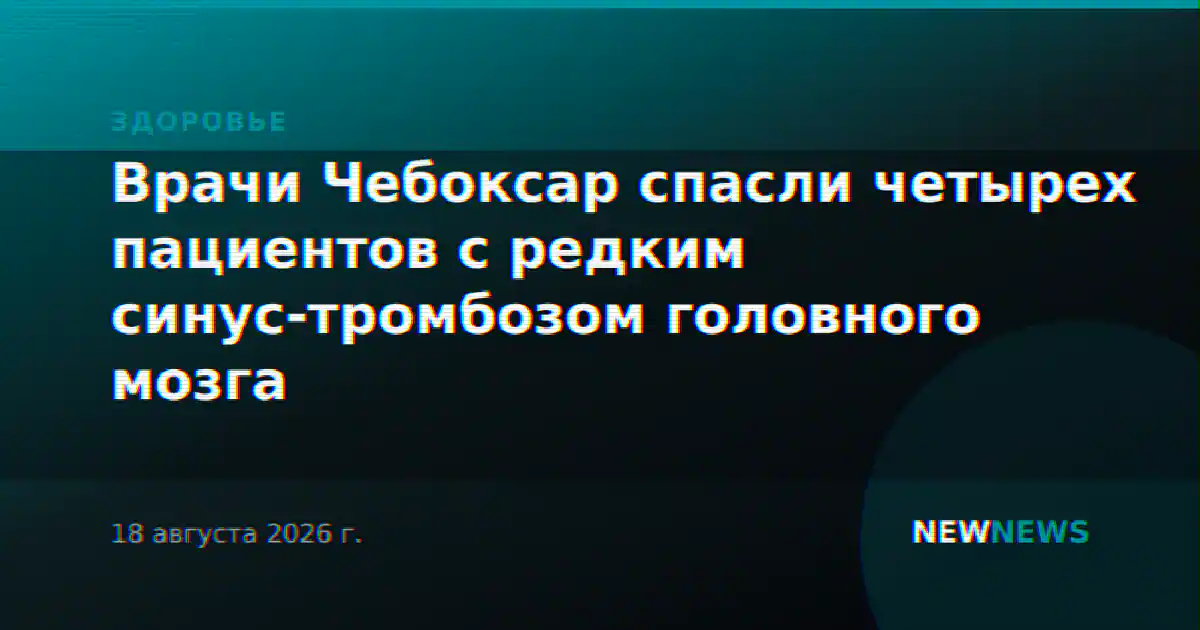 Врачи Чебоксар спасли четырех пациентов с редким синус-тромбозом головного мозга
